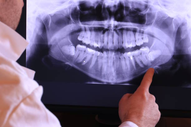 Best Walk-In Emergency Dentist in Havana, IL