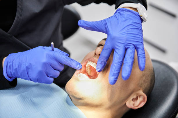 Best Emergency Tooth Extraction in Havana, IL