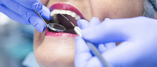 Best Emergency Root Canal Treatment in Havana, IL